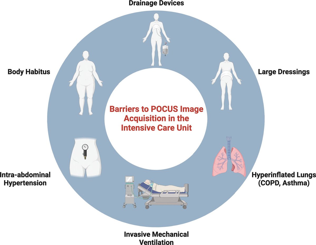 CritCareReviews's tweet photo. Point-of-Care Echocardiography in the Difficult-to-Image Patient in the ICU

CCR Journal Watch
https://t.co/Sp06oA6IDG

Get the latest critical care literature every weekend via the CCR Newsletter - subscribe at https://t.co/nitMzacLrj https://t.co/ASHjgElSro