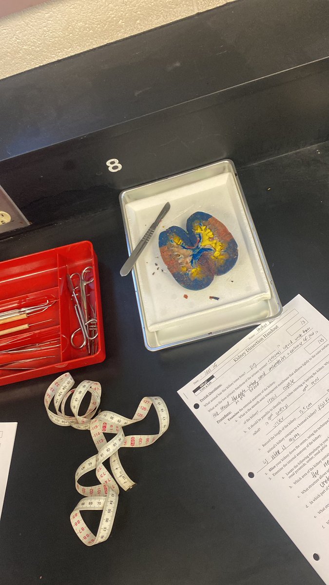 _prowe's tweet photo. Just dissected a kidney wbu tdy https://t.co/Y7uQyO3h75