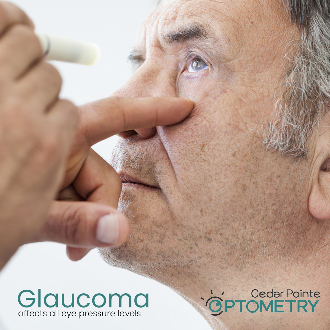 CedarPointeODs's tweet image. Don't rely solely on pressure tests; they may miss certain types of glaucoma. Comprehensive exams are crucial for early detection. Optic nerve health and visual field tests are important. Prioritize regular exams to protect your vision. #GlaucomaAwarenessMonth #EyeHealthMatters
