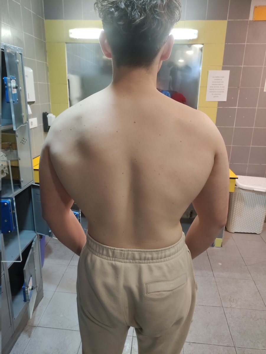NikBok2's tweet photo. La espalda en volumen va pillando forma! https://t.co/Jl9NX3lHfq