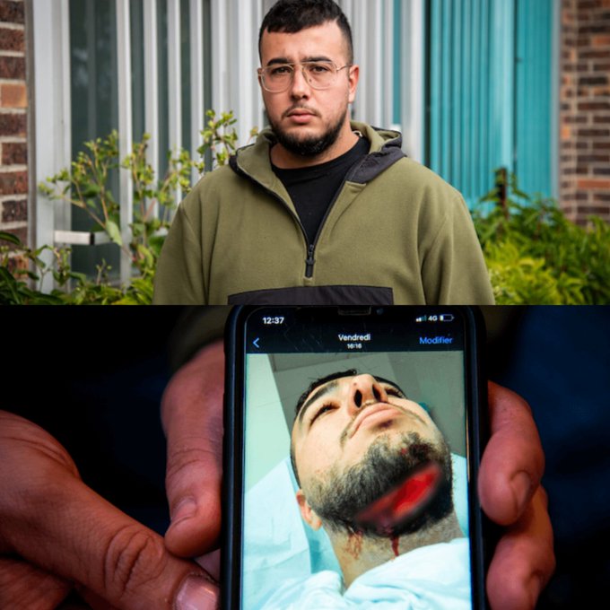 CerfiaFR's tweet photo. 🇫🇷 FLASH | L'homme de 76 ans qui a tenté d'égorger Mourad, le jardinier de 29 ans en l'insultant de "bougnoule" en novembre, a été condamné à 4 ans de prison dont 1 ferme. https://t.co/LKMQja8X1f