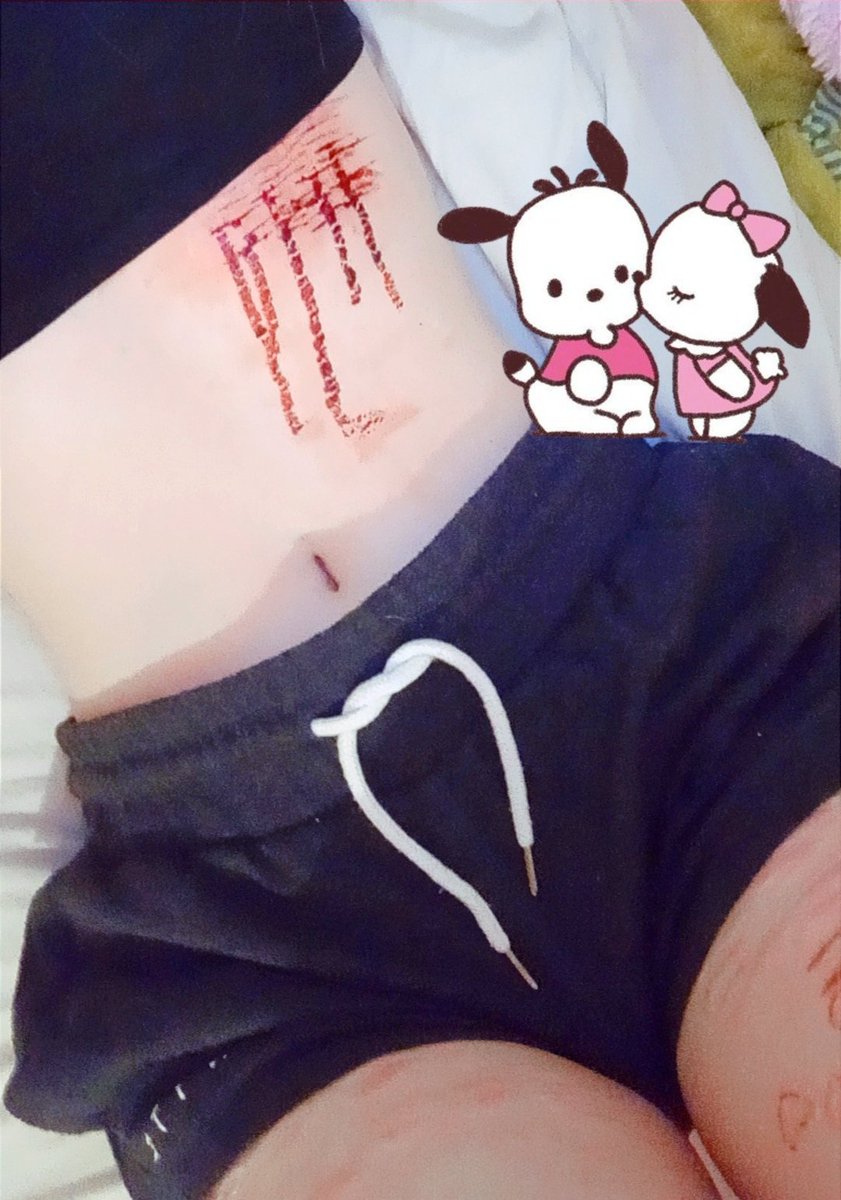 it stings so bad I'm gonna die and my cause of death will be boo-boo