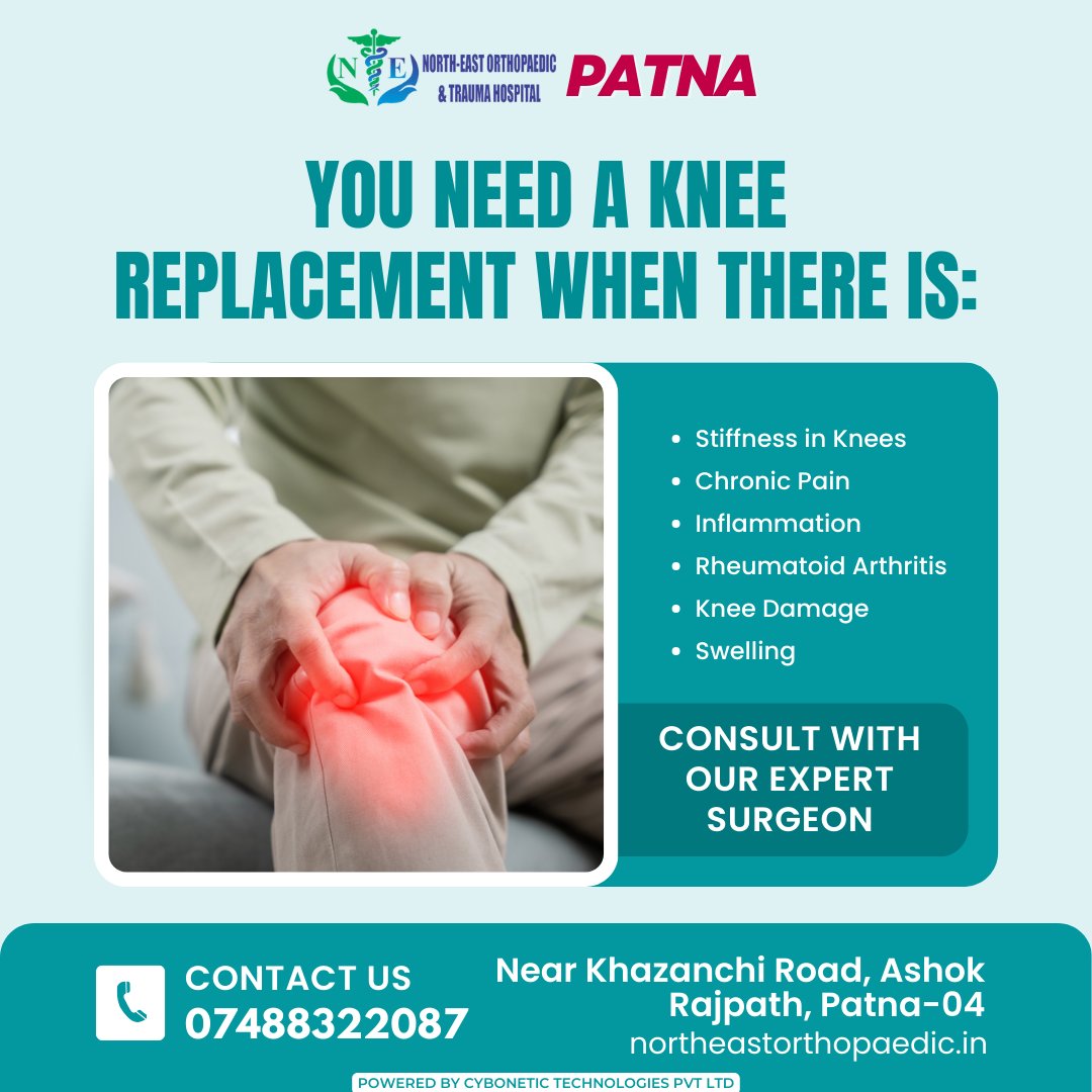 northorthopedic's tweet photo. 🩹 Consider a knee replacement when there's a need for renewed mobility and comfort.
Book an Appointment:
☎+91-74883-22087
🌐https://t.co/6TA7Mq1QI2
#KneeReplacement #KneeSurgery #KneePain #KneeHealth #JointSurgery #Swelling #KneeDamage #Stiffness #NewBeginnings #JointHealth https://t.co/ndSmW5QWSj