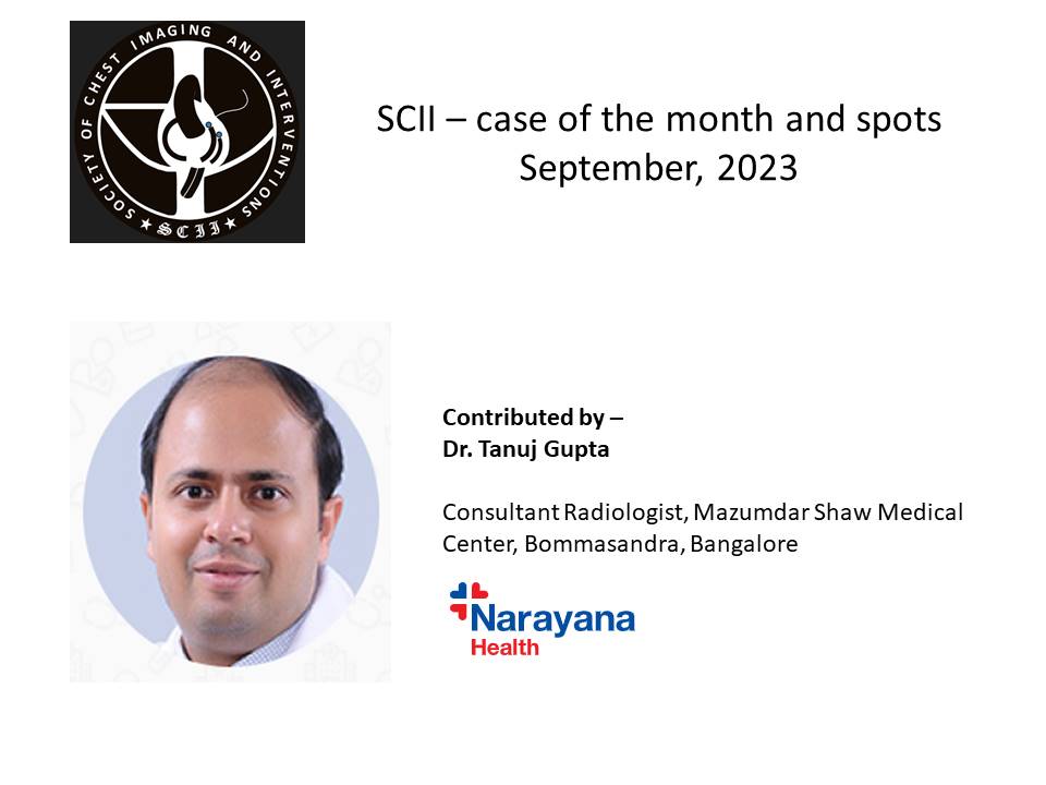 Chest_Imaging's tweet photo. https://t.co/XYJ6DiNJU0