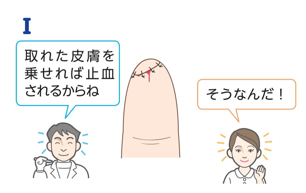 TFE1207's tweet photo. スライサーや包丁で指先をちょこっと切断した場合は、取れた指先の皮膚を持って受診してもらえるとありがたいです☺️。
取れた皮膚を移植すると生着する場合もあるし、移植した皮膚は止血効果が高く最高の創傷被覆材になります！
受診の際は、形成外科の医師がいるか確認してもらえるとなお良しです☝️ https://t.co/qo0hj0IqZp