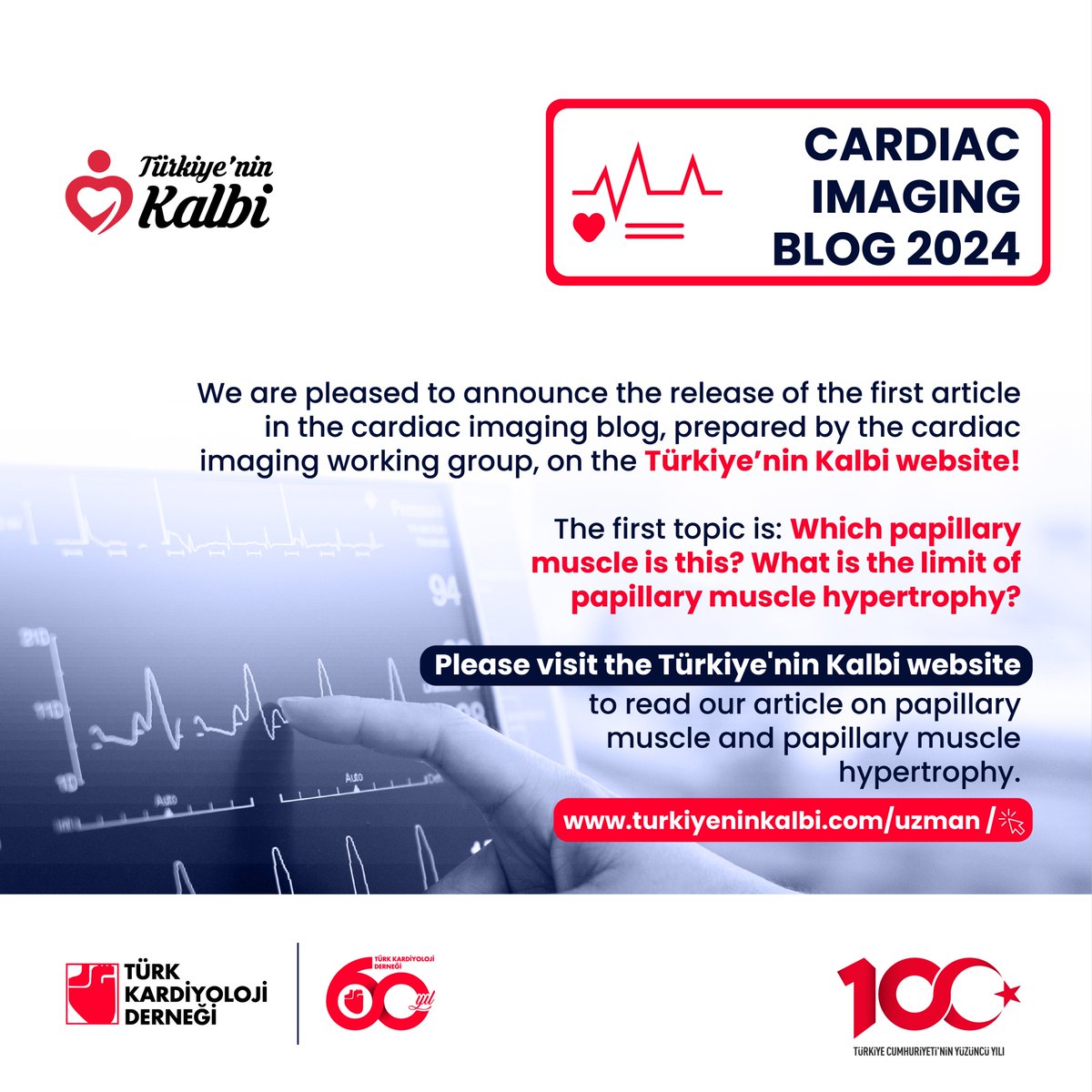 TKDResmi's tweet photo. Please visit the Türkiye'nin kalbi website to read our blog post on papillary muscle and papillary muscle hypertrophy.
👉 https://t.co/2bLJEevvAW https://t.co/T50wWK2FO5