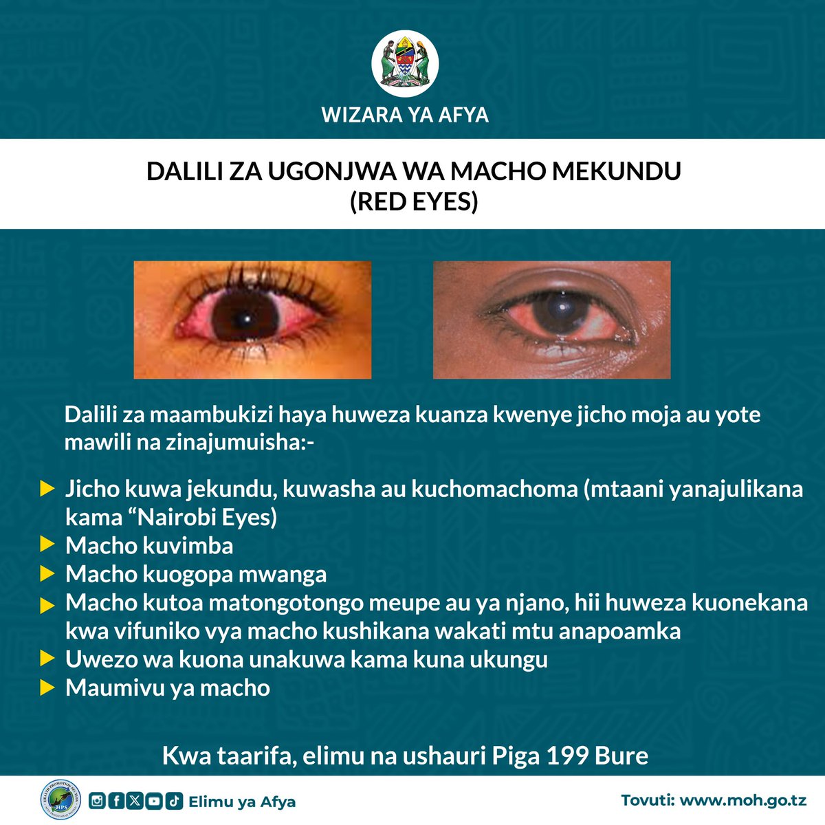 wizara_afyatz's tweet photo. Dalili za ugonjwa wa Macho mekundu (Red Eyes) https://t.co/cDkkMq2y9h
