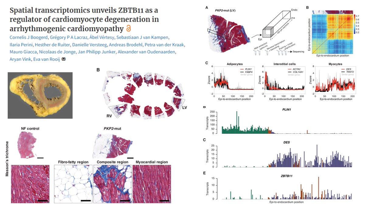 HaoYin20's tweet photo. Transcriptional driver ZBTB11 of #Cardiomyocyte degeneration (#Autophagy #Apoptosis) in PKP2 #ArrhythmogenicCardiomyopathy
Tomo-seq
RNAseq of 214 100-μm cryosections of👤LV wall
Epicardium-to-Endocardium🤠
#SpatialTranscriptomics
#CardiovascRes 2022
https://t.co/OXdvi0w5lN https://t.co/XUoY2z1T4X