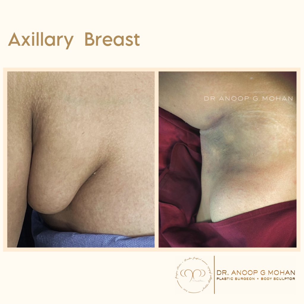 The best result is one where you leave no evidence of a surgery….”
Dr Anoop G Mohan