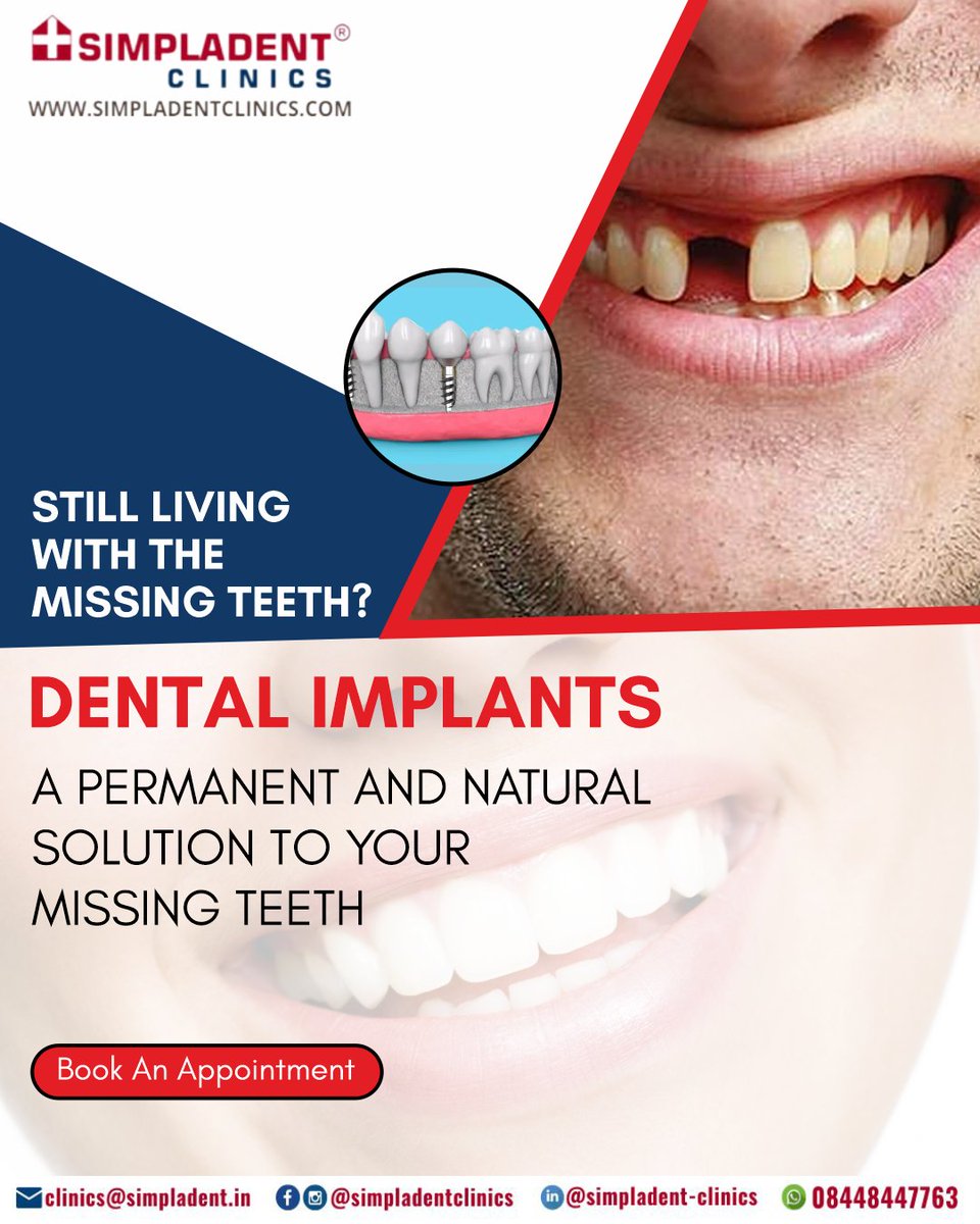SimpladentC's tweet image. Still Living With The Missing Teeth?

Dental Implants A Long-Lasting And Natural Solution For Missing Teeth‼

Book An Appointment Today. 👇
📞 +91-8448447763
✉ clinics@simpladent.in
🌐 simpladentclinics.com
📍 g.page/r/CZdJVQ-8OsDd…

#DentalImplants #ImmediateLoading