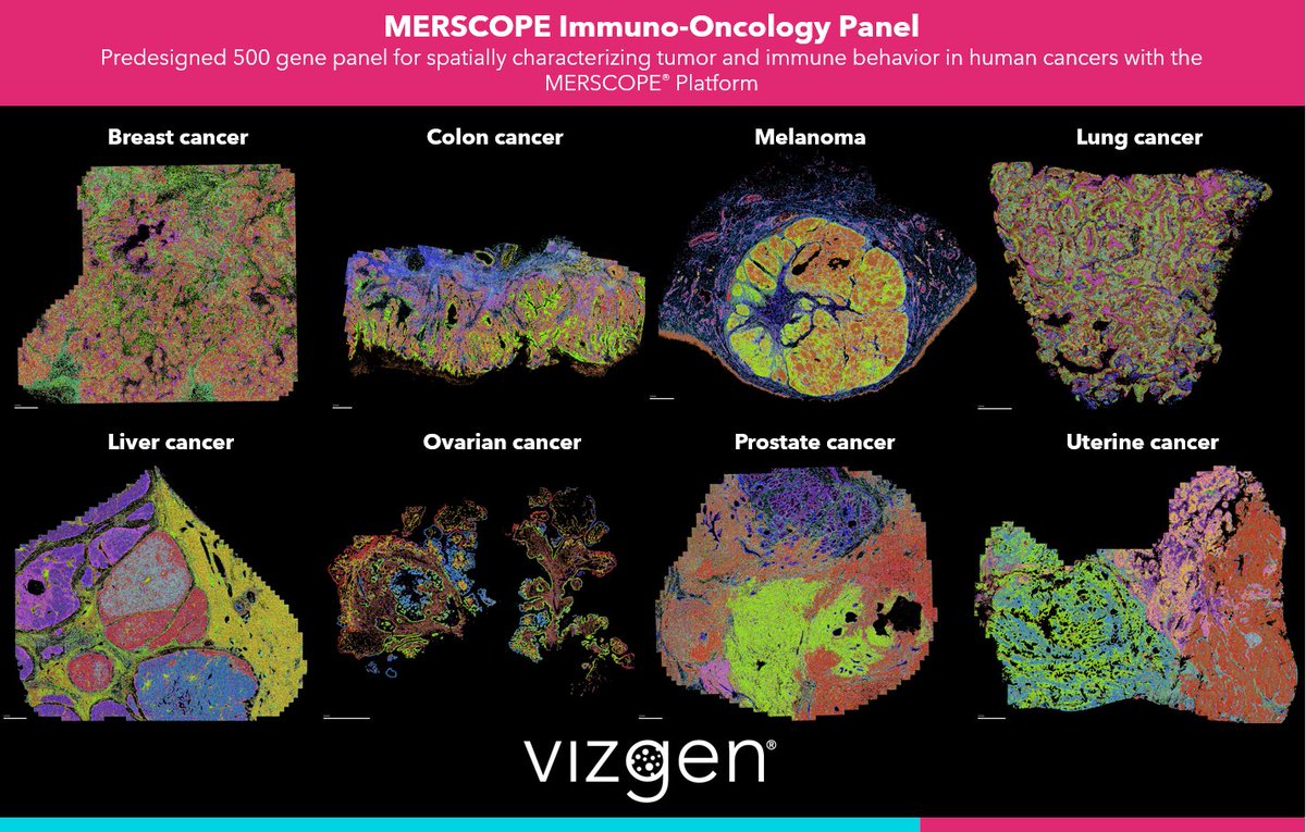 vizgen_inc's tweet photo. We used our #MERSCOPE #ImmunoOncology #PredesignedPanel to generate the MERSCOPE FFPE Human Immuno-Oncology Data Release.
Access the data today and explore the characterization of #Immune #CellTypes in the human #TumorMicroenvironment: https://t.co/KpzwkzoM7L
#AcademicTwitter https://t.co/Yr9KwXfvjh