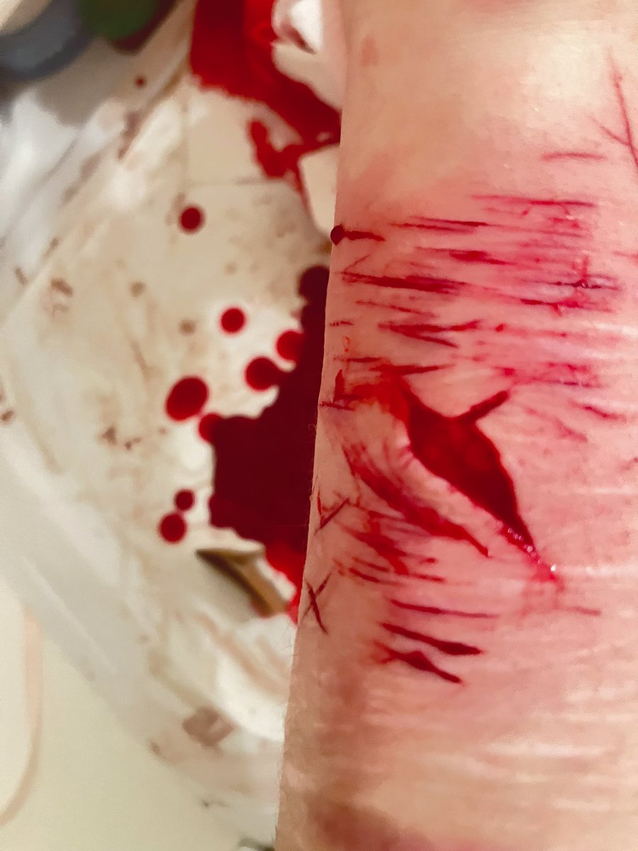 cals_kill_me's tweet photo. theres something so cathartic about washing the blood off and seeing how beautiful they look- shtwt beanstwt https://t.co/ORzl1ghFi3