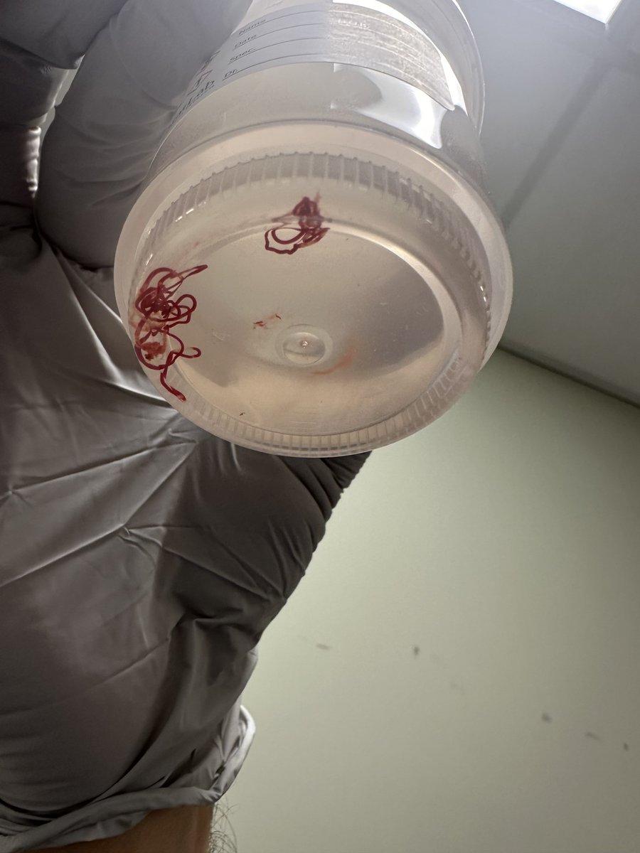 Erik Holzwanger, MD, ABOM-D tweet media