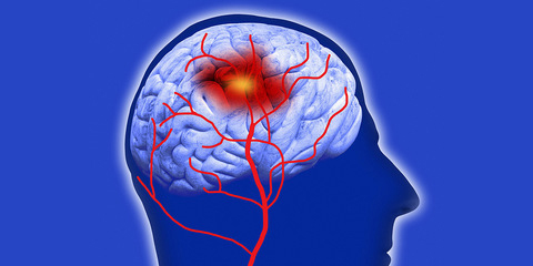 WebMD's tweet photo. People who eat dinner after 9 p.m. may have a 28% higher risk of cerebrovascular disease such as stroke compared with those who eat before 8 p.m., a new study warns. https://t.co/tyWQtv7qZu https://t.co/DmCg3y40ck