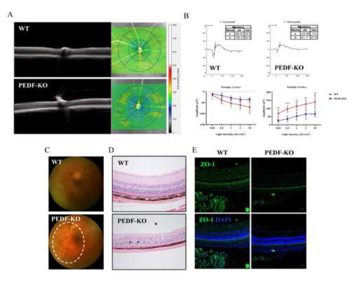 📢New in GeroScience
PEDF protects retinal pigment epithelium from ferroptosis and ameliorates dry AMD-like pathology in a murine model by Wei Xiang et al.
link.springer.com/article/10.100…
#Pigmentepithelialderivedfactor #ferroptosis #ageing #maculardegeneration #retinalpigmentepithelium