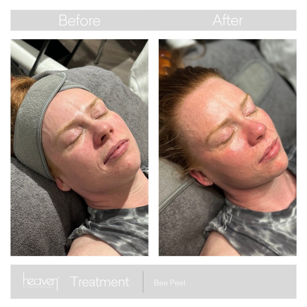 heavenskincare's tweet photo. Self-care isn't a resolution; it's a commitment! Book your facial now and start the year with a fresh and glowing complexion 💖 https://t.co/0a0G7qoQm8

#SelfCareJourney #FacialTime #investinyourself #skintips #skingoals #healthyskin #SelfCare #NewYearSelfCare https://t.co/CBaQxR5BJe
