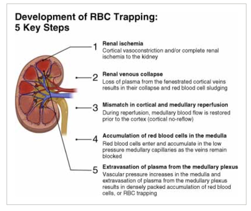 Sarah R. McLarnon (@s_ray_09) on Twitter photo This review also highlights the hypotheses surrounding the development of RBC trapping as well as summarizes the newest data from the <a href="/PaulMOConnor1/">Paul O’Connor</a> lab regarding it's initiation This review also highlights the hypotheses surrounding the development of RBC trapping as well as summarizes the newest data from the <a href="/PaulMOConnor1/">Paul O’Connor</a> lab regarding it's initiation