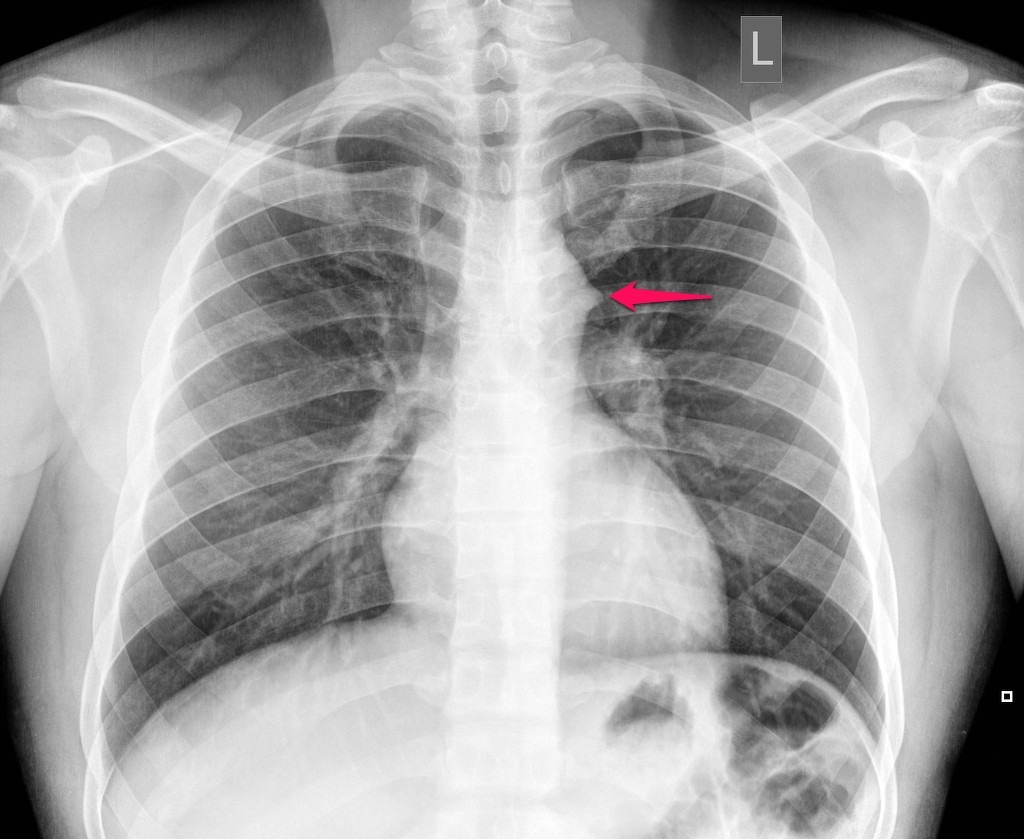 MoreXGrok's tweet photo. 30 years
Male

Incidental finding. ... https://t.co/zhqZonKI5Y
