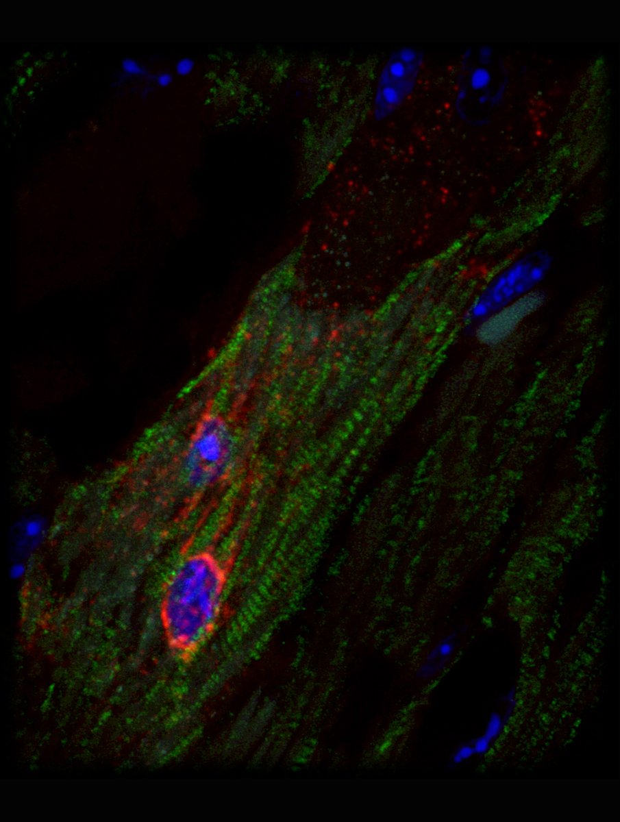 Neue Ansatzmöglichkeiten für zielgerichtete #Therapien bei Myokarditis: #Forscher*innen der @Uniklinik_Fr und der @UniFreiburg finden Schlüsselakteur bei viralen #Herzmuskelentzündungen - den sogenannten Immunzellrezeptor GPR15. Mehr: t1p.de/gnt7l