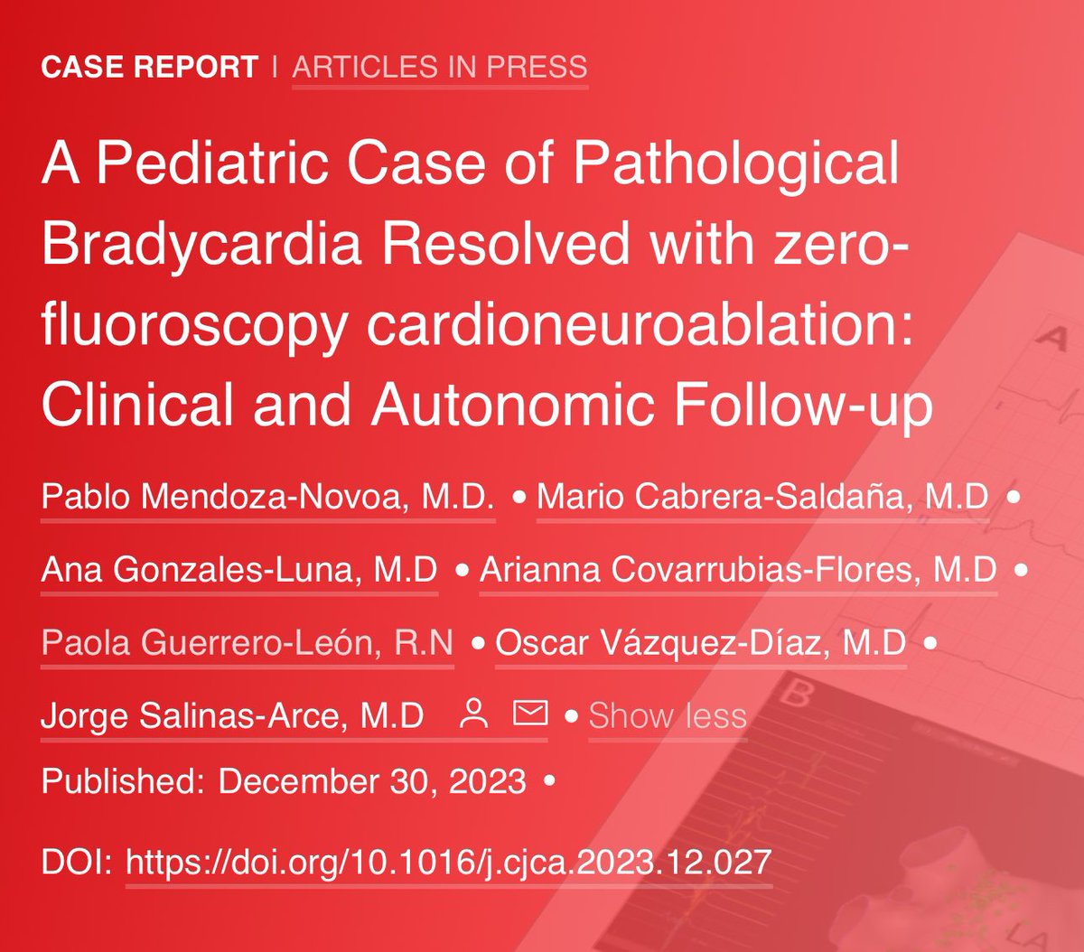 Dr. Oscar Vázquez (@oscarvazquezep) on Twitter photo We recently published our first experience of #Cardioneuroablation in a pediatric patient. Thank you for the invitation <a href="/PabloMendoza10/">Pablo Mendoza</a> <a href="/mariorcs86/">Mario Cabrera</a>. #EPepps #ZeroFluoro #ICEeyes #LATAM 🇵🇪 🇲🇽
onlinecjc.ca/article/S0828-… We recently published our first experience of #Cardioneuroablation in a pediatric patient. Thank you for the invitation <a href="/PabloMendoza10/">Pablo Mendoza</a> <a href="/mariorcs86/">Mario Cabrera</a>. #EPepps #ZeroFluoro #ICEeyes #LATAM 🇵🇪 🇲🇽
onlinecjc.ca/article/S0828-…