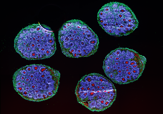 chrost_hugo's tweet photo. Human brain organoids showing neurons and their dendrites (green), telencephalic (forebrain) cells (blue), and a kind of cell-cell contact called tight junctions (red).

Credit: Noelia Anton Bolanos and Irene Faravelli

#MedTwitter #neuroscience https://t.co/RLXksBKLHq