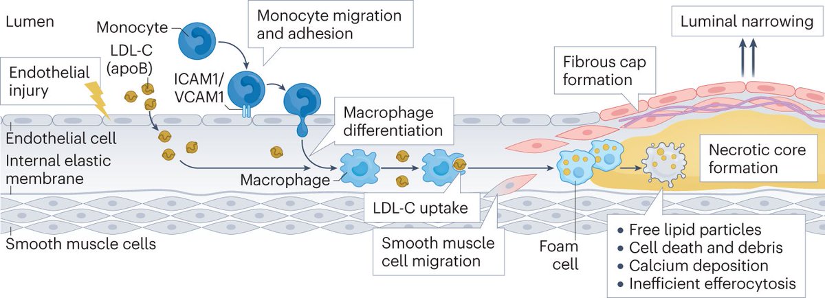 Nature Reviews Cardiology (@natrevcardiol) on Twitter photo Hot off the press! <a href="/AshishSarraju/">Ashish Sarraju</a> & Steven Nissen review the clinical evidence for atherosclerotic plaque stabilization and regression: rdcu.be/dvarz
<a href="/CleClinicHVTI/">Cleveland Clinic Heart, Vascular & Thoracic</a> Hot off the press! <a href="/AshishSarraju/">Ashish Sarraju</a> & Steven Nissen review the clinical evidence for atherosclerotic plaque stabilization and regression: rdcu.be/dvarz
<a href="/CleClinicHVTI/">Cleveland Clinic Heart, Vascular & Thoracic</a>