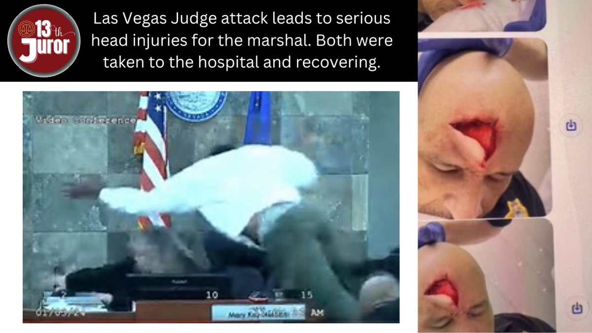 BrandiNChurch's tweet image. 🚨GRAPHIC WARNING!!🚨
We all saw the video of the judge in Las Vegas being attacked by the man she had just denied probation for... these are the injuries the marshal sustained. Yikes! 
#lasvegas #judge