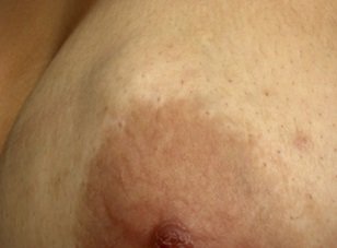 kitsak_j's tweet photo. CW : MENTION OF BREAST

hello po, sorry po pero kakapalan ko na talaga mukha ko, if you have the means po na tulungan ako because i don't have money to pay for my mothers medical bill kasi she have a bukol sa kanyang breast and it needs to be operated immediately or else + https://t.co/4kg8Kkwdlt