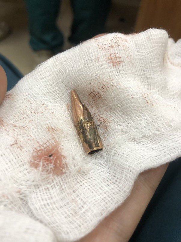 swilkinsonbc's tweet image. I had to get a bullet out of a 5yr-old boy in the emergency room: he was shot from an israeli aircraft at an UNRWA school @IssamAboim64917