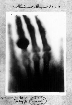 SciChronicle365's tweet photo. 🔍 #OnThisDay in 1896, an Austrian newspaper unveiled Wilhelm Roentgen's groundbreaking discovery: X-rays. This discovery sparked an immense public interest and ignited a new era of scientific exploration. #WilhelmRoentgen #XRayDiscovery https://t.co/UIBPiWAvc9