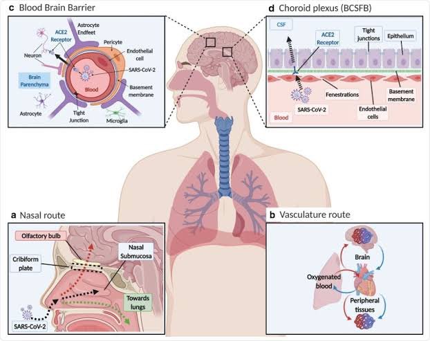 SARS-CoV-2 triggers acute encephalopathy as a serious complication in children. A new study investigated epidemiological differences in SARS2-associated encephalopathy during the BA.1/BA.2 & BA.5 predominant periods & also between SARS2-associated & non-SARS2-encephalopathy. 1/