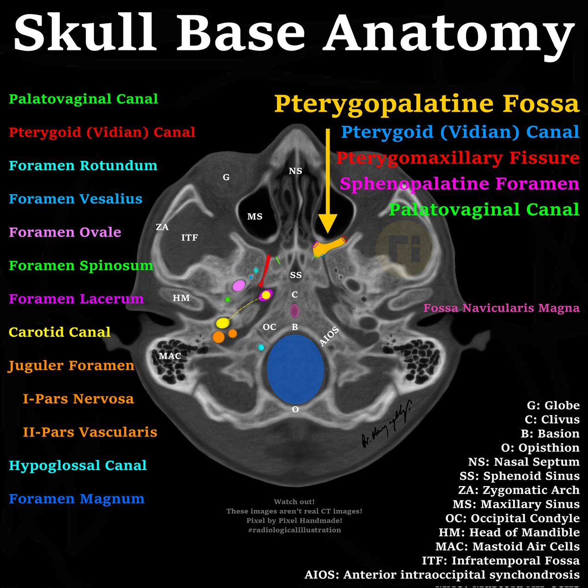 drharunyildiz's tweet photo. Skull Base Anatomy 

#radiologicalillustration ✍️
pixel by pixel handmade! https://t.co/79zk39vPuA