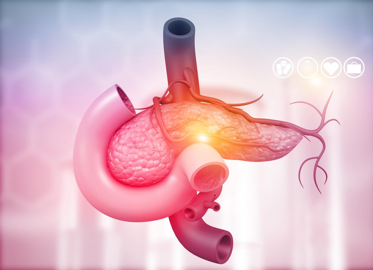 #OnlineFirst: Read the In The Spotlight commentary, Exploring the role of hyperinsulemia in obesity-associated tumor development, by @ZCMlab discussing a recent @Cell_Metabolism paper from @JanelKopp et al. bit.ly/48GFdrX @OSUCCC_James