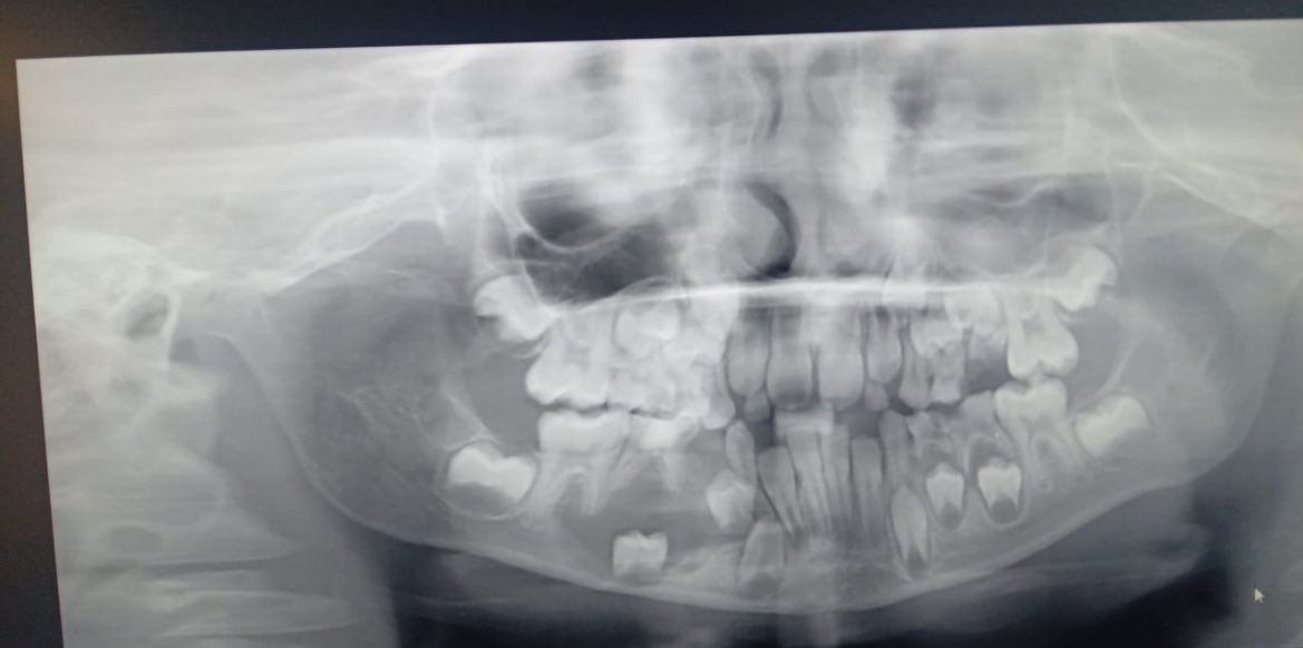 ايش تشخيص الحالة؟