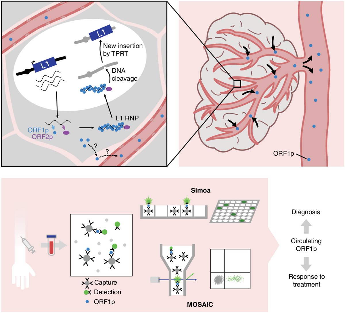 In the Spotlight from the latest issue—
Noninvasive and multicancer biomarkers: The promise of LINE-1 retrotransposons, by @Orel_Doucet and <a href="/retrogenomics/">Gael Cristofari</a>.
bit.ly/4aLz7bS
<a href="/ircaninstitute/">IRCAN</a> <a href="/inserm/">Inserm</a> @uca_research <a href="/CNRS/">CNRS 🌍</a>