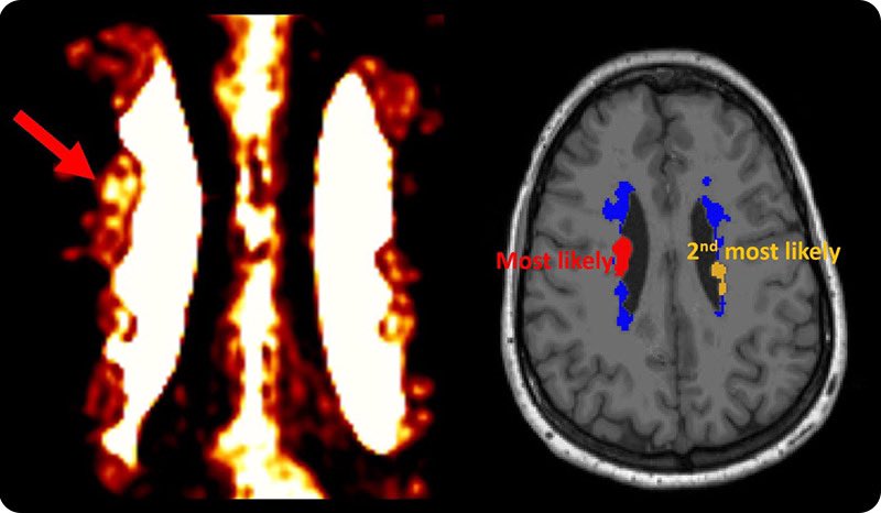 Irene Wang, PhD, FAES tweet media