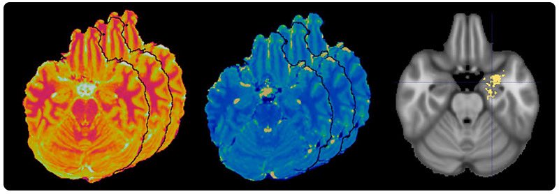 Irene Wang, PhD, FAES tweet media