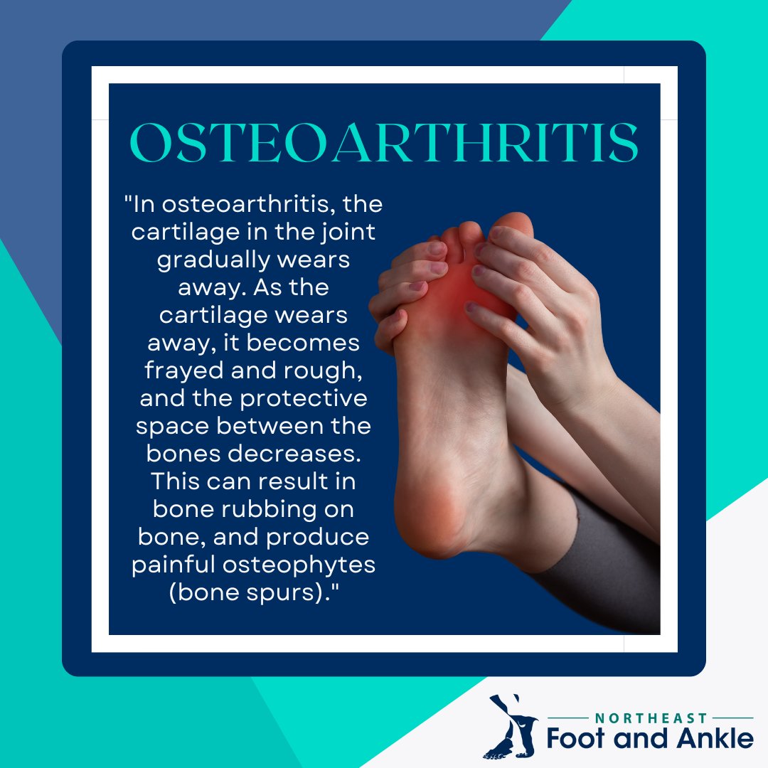 orthoinfo.aaos.org/en/diseases--c…
.
.
.
#arthritis #osteoarthritis #footarthritis #bonespur #inflammation #jointinflammation #jointpain #painrelief #arthritispain #bestpodiatrists #podiatrist #podiatrypractice #podiatryclinic #follow #NortheastFootAndAnkle