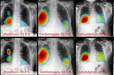 Radiology_AI's tweet photo. Revisiting Trustworthiness of Saliency Methods in Radiology #AI https://t.co/mFxAtNFEpL @pingkunyan @rpi_bme @Abner29992112 #SaliencyMap #ExplainableAI #DeepLearning https://t.co/CcUx9kjCjt