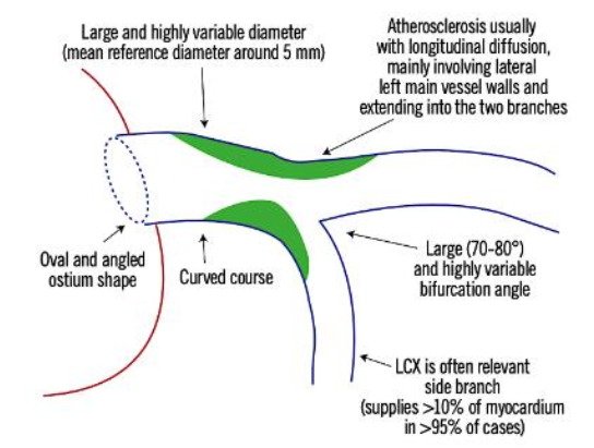 Can we use provisional stent strategy in complex #bifurcation lesions?

➡️ pcronline.com/Cases-resource…

Learn from this practical session 📺 which includes a lecture about provisional stenting in left main vs non left main complex bifurcation stenoses and 3 practical cases shared by