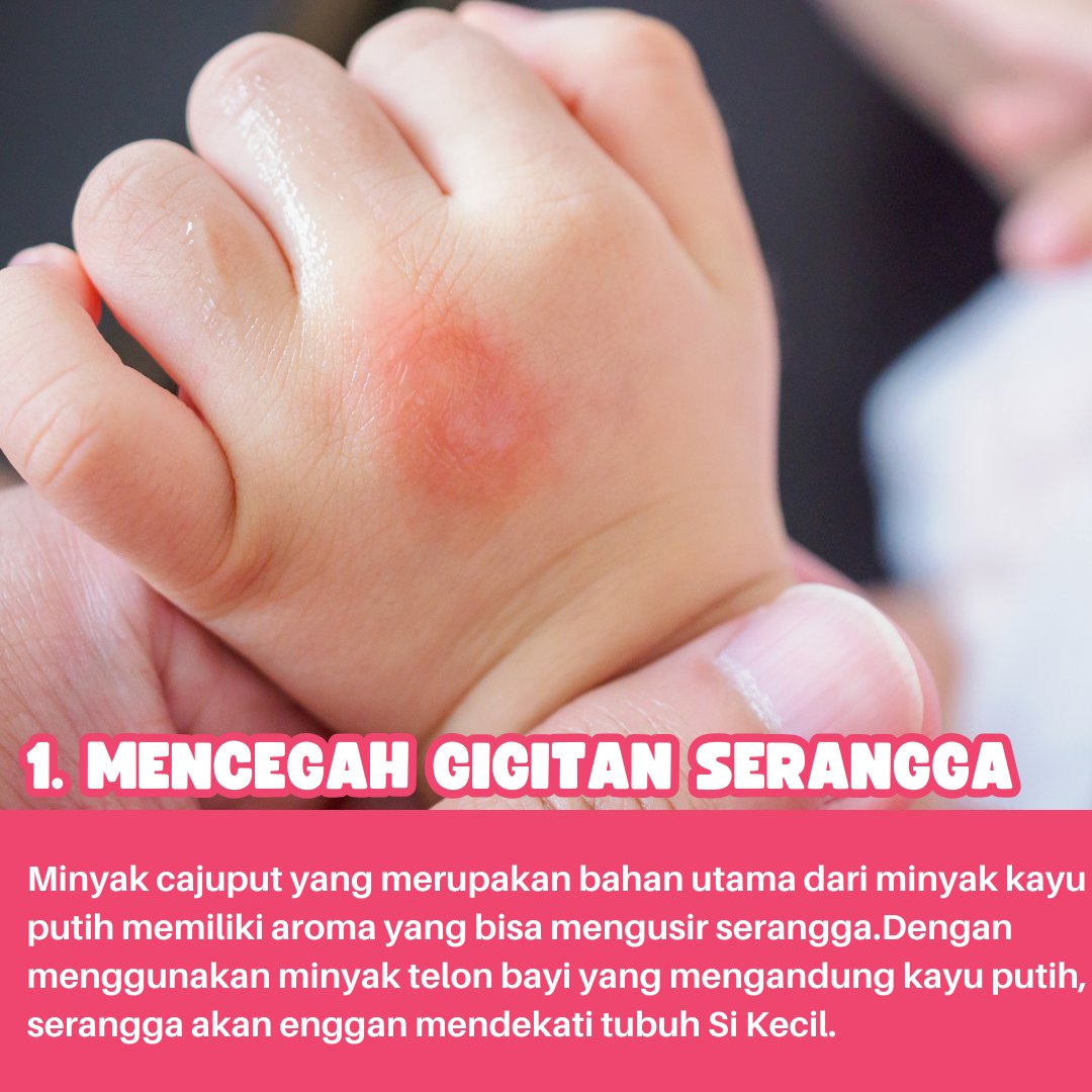 welovesupermom's tweet photo. Minyak telon bukan hanya aroma yang menyenangkan, tapi juga memberikan sensasi hangat yang menenangkan bagi bayi #PerawatanBayi #MinyakTelon #KenyamananBayi

Baca selengkapnya di: https://t.co/aghDLO2n8I https://t.co/BH7urOGrcB