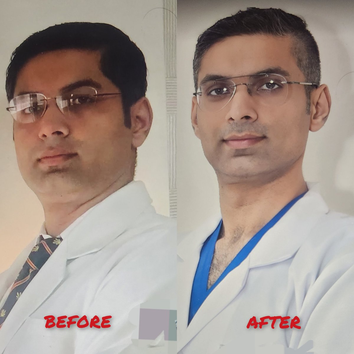 drvipulaggarwal's tweet image. "The benefits of exercise are
unbelievable... But if you have to exercise to keep your weight down, your diet is wrong."