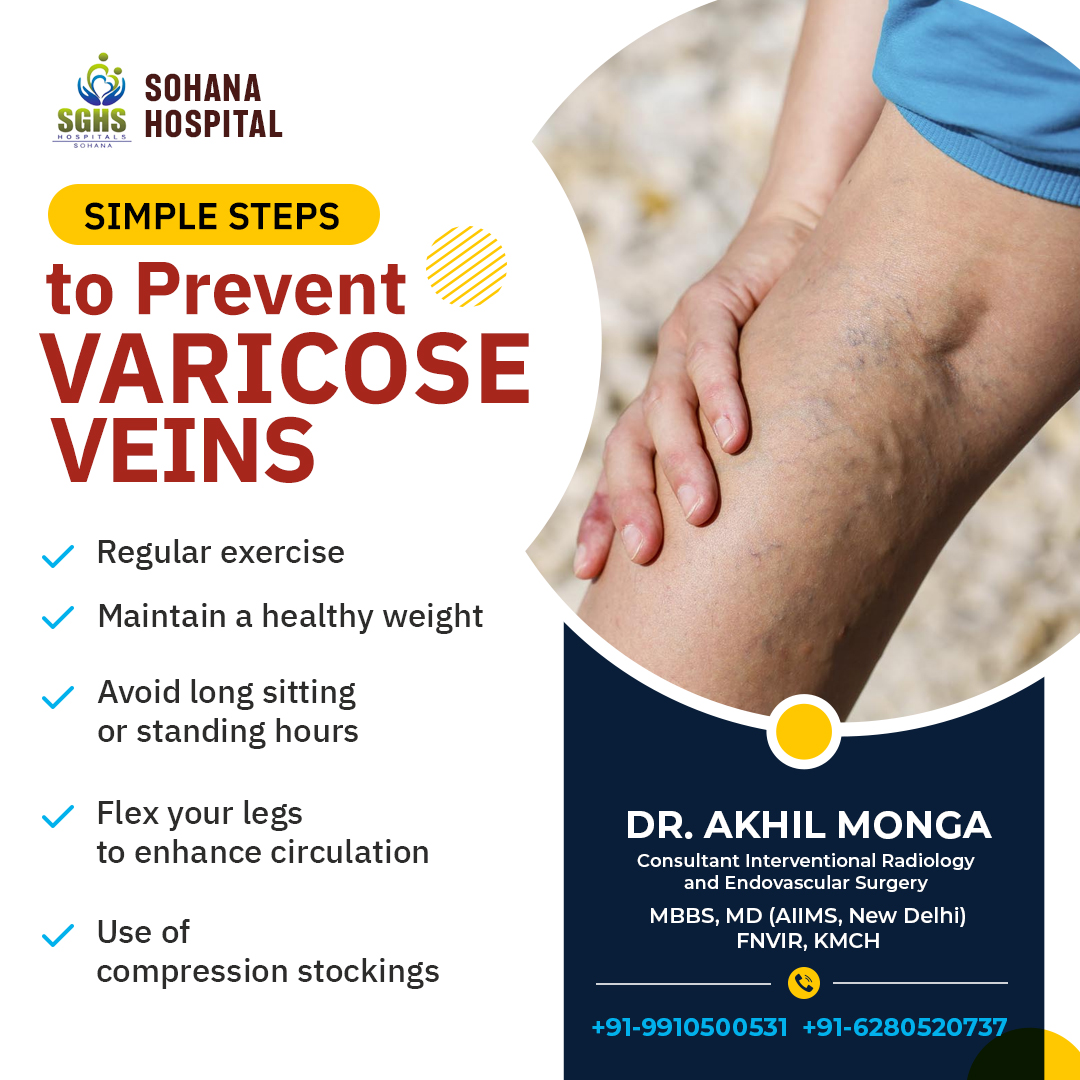 Prevention is always better than cure! If you want to avoid varicose veins follow the steps mentioned below. These steps can help reduce the risk of varicose veins problem. bit.ly/3X0x64x #varicoseveins #varicoseveinsPrevention #regularexercise #avoidprolongsitting