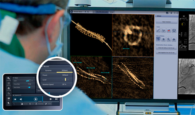 Una nueva innovación de @GEHealthCare_ES, proporciona a los #cardiólogosintervencionistas imágenes del #stent coronario en 3D durante la intervención, sin necesidad de contraste, dispositivos o costes adicionales.
#3DStent #TecnologíaSanitaria pmsl.es/f5