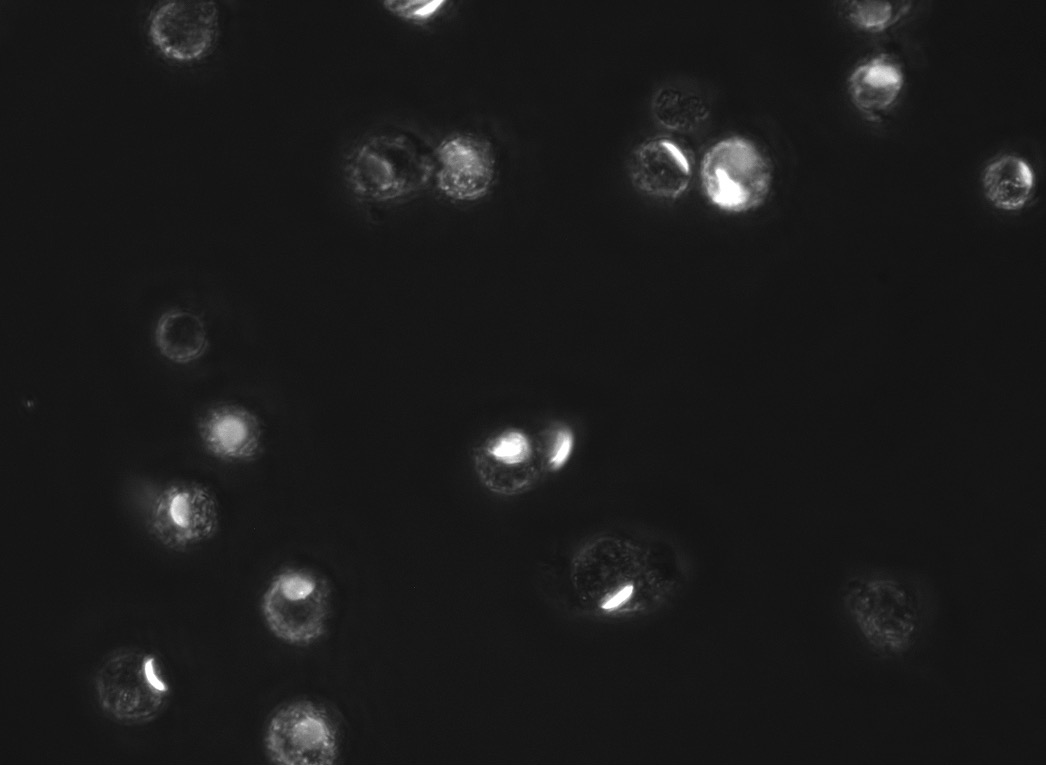 Look at these particles that resemble many little planets (so cute!). They are actually cells with disk-shaped microparticles that allow us to make invisible injuries 'visible'. 

Check out our paper freshly published in Science Translational Medicine at: lnkd.in/d9GTeKc6