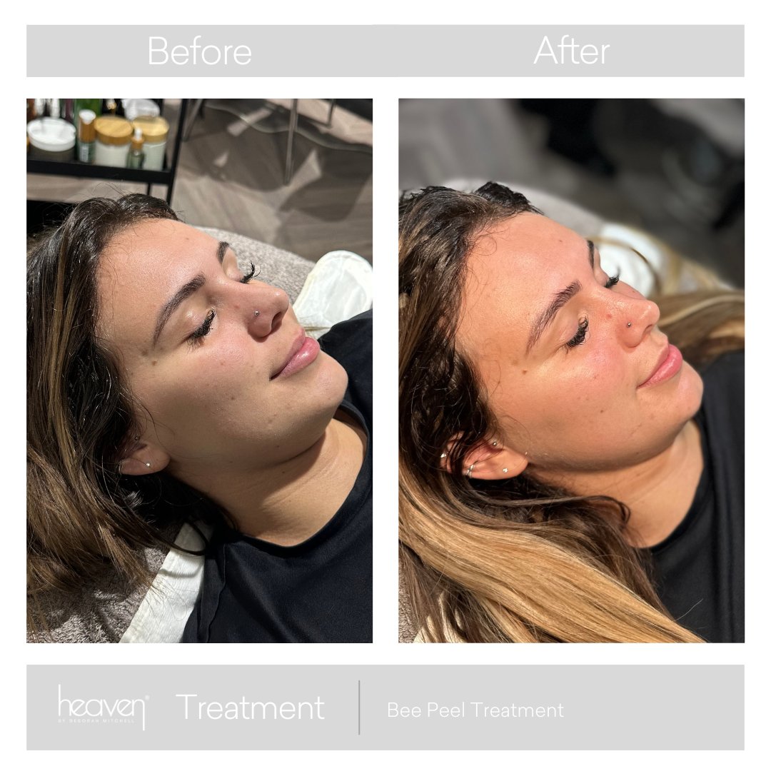 heavenskincare's tweet photo. Step into the new year with confidence! Keep your self-care promise by booking a facial and embracing the glow from within ✨ https://t.co/0a0G7qoiwA

#SelfCareJourney #FacialTime #investinyourself #skintips #skingoals #healthyskin #SelfCare #NewYearSelfCare https://t.co/DKIj0g46x0