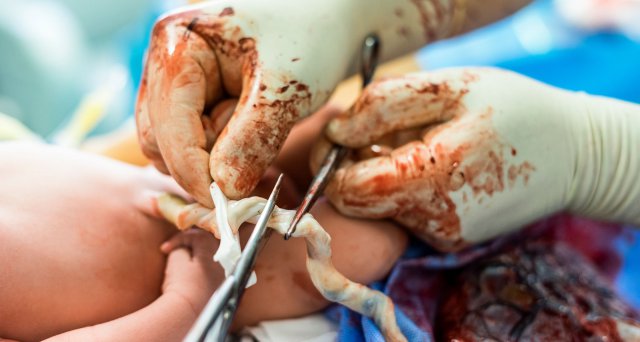 Dt_Aerzteblatt's tweet image. Nabelschnurblutspenden in Deutschland rückläufig, Relevanz könnte zunehmen:  Dresden/Düsseldorf – Im Gegensatz zu anderen europäischen Ländern spielen hämatopoetische Stammzellen aus Nabelschnurblut, dem Restblut aus der Plazenta,… dlvr.it/T10grk #DKMS #ZKRD #HSCT