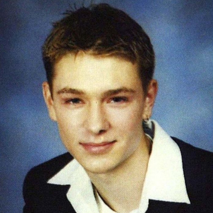 Chad Michael Murray Before And After Nose Job Chad Michael Murray