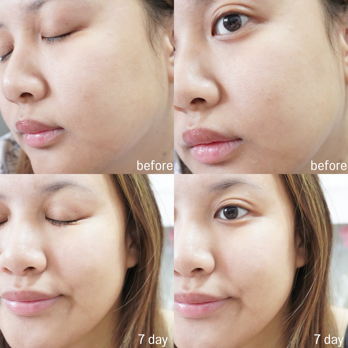 hyccnn's tweet photo. อะหลังจากตามมานาน ได้ลองใช้ Retinol Serum ของ Kiehl’s แล้วว ตัวช่วยผิวกระจก สุขภาพดี 💦 ช่วยให้ริ้วรอยให้ลดเลือนลง เนื้อเค้าจะเป็นเซรั่มเนื้อเข้มข้น ซึมไวไม่หนักหน้าเลย ไฮใช้เป็นรูทีนตอนกลางคืน ผลลัพธ์ออกมาหลังใช้มา 2 อาทิตย์ประทับใจมากกก ตื่นมารับผิวฉ่ำสุด รอยก็ลดลง อ่อนโยนต่อผิวใช้ได้ทุกวัน ขึ้นแท่นลูกร้ากก💗 #ใช้ดีบอกต่อ