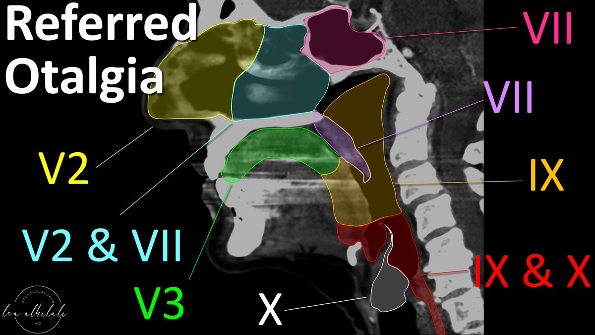If you are only looking at the ears in patients w/otalgia, you need LISTEN UP! In 50% of cases, the source of pain isn’t the ear! So-called “referred otalgia” comes from other nerves in the head & neck Do YOU know which? I’ll show you how to remember them—just hear me out!